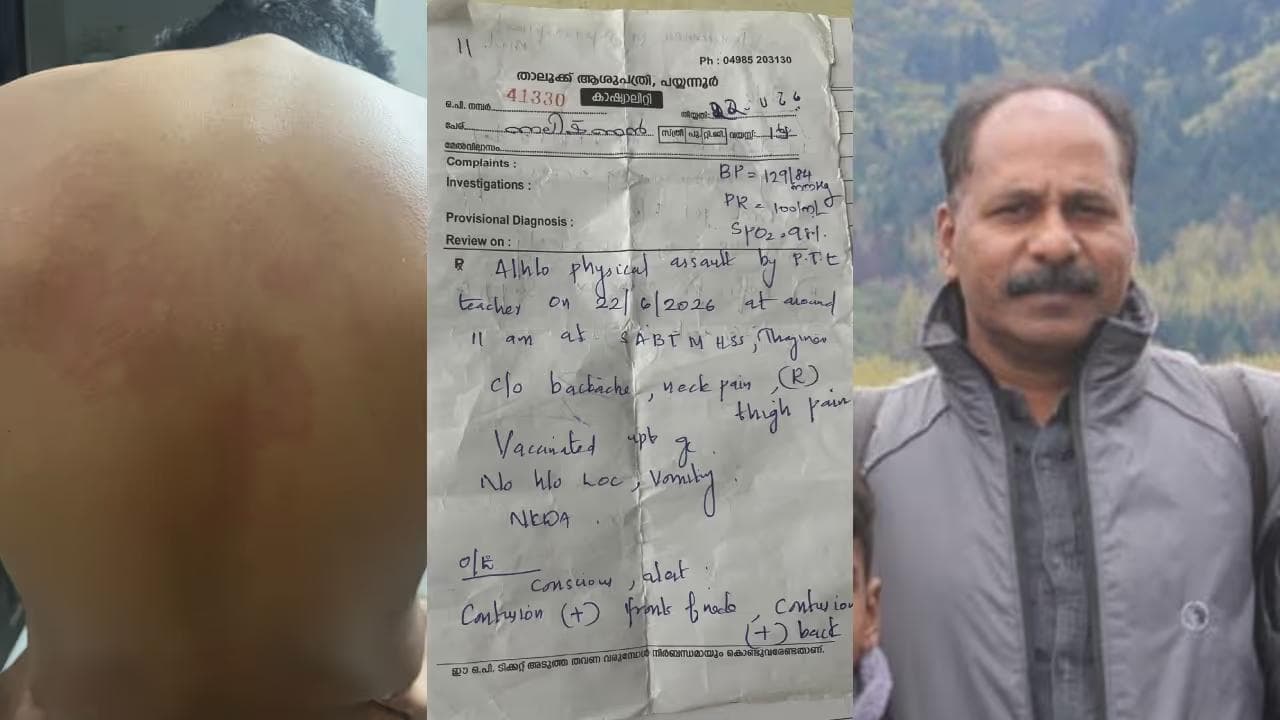 പയ്യന്നൂരിൽ എട്ടാം ക്ലാസ് വിദ്യാർത്ഥിക്ക് നേരെ ക്രൂരമർദ്ദനം