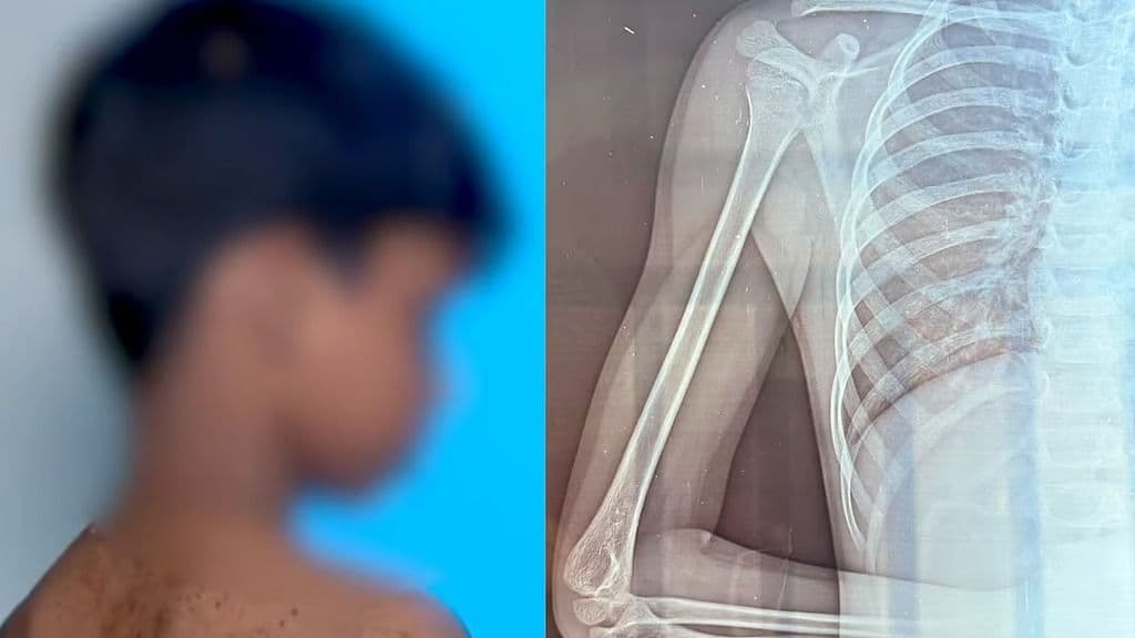 മട്ടന്നൂരിൽ രണ്ടാം ക്ലാസ്സുകാരന് മർദനം: അധ്യാപകനെതിരെ കേസ്